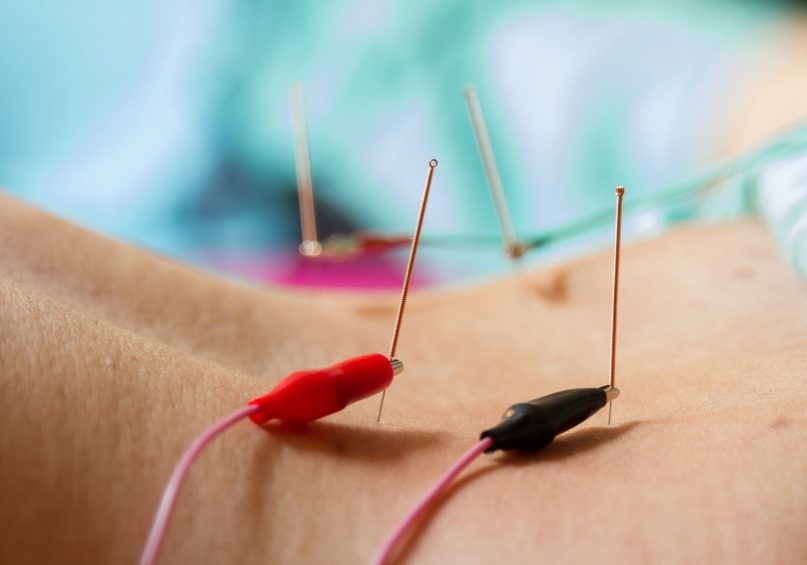 Can acupuncture help lower blood pressure